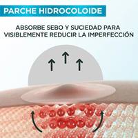 Como funciona el parche para granos